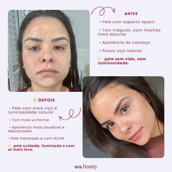 Sérum Hidratante Facial (Niacinamida + Rosa Mosqueta) 30 ml